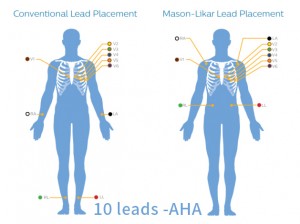 10-leads--AHA(1)