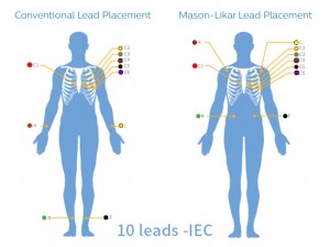 10-leads--IEC(1)