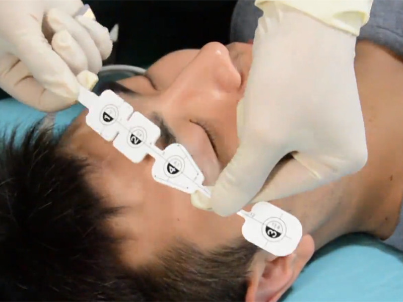 Capteur EEG jetab ki pa pwogrese Medlinket la ede kontwole pwofondè anestezi a.